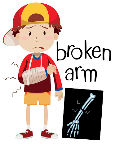 Boy with broken bone and x-ray .