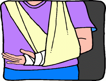 Broken Arm Clip Art Cliparts  - Broken Arm Clipart
