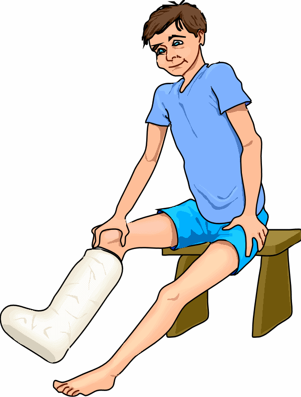 Broken Foot Cartoon Free Clip - Broken Leg Clipart