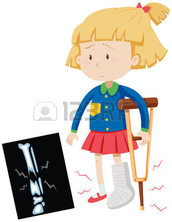 broken leg: Little girl with broken leg illustration Illustration