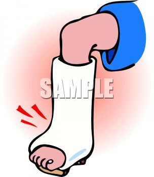 Broken Foot Cartoon Free Clip