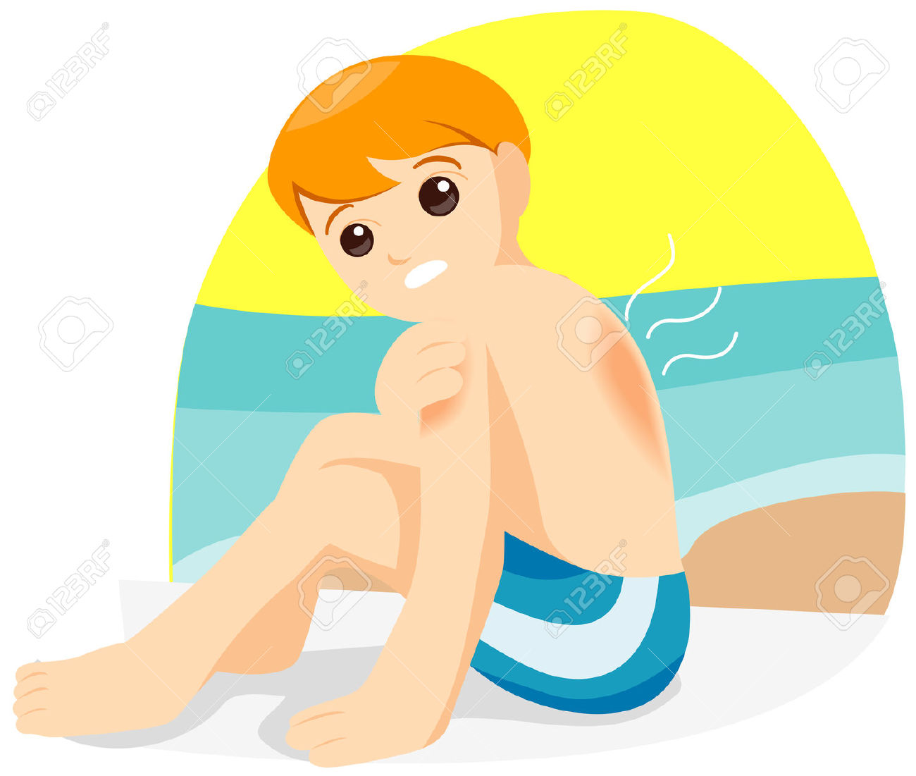 Child with Sunburn with Clipp - Sunburn Clipart