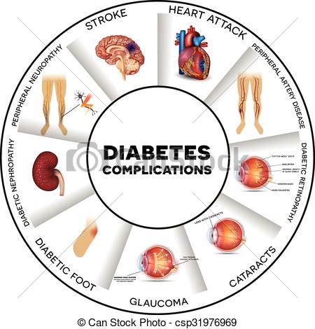 Diabetes affects... Diabetes complications Clip Art ...