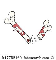 gross broken bone cartoon - Broken Bone Clipart