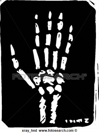 Hands X-ray Clipart - Clipart Kid
