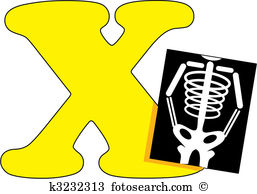 Letter X with an X Ray - Xray Clip Art