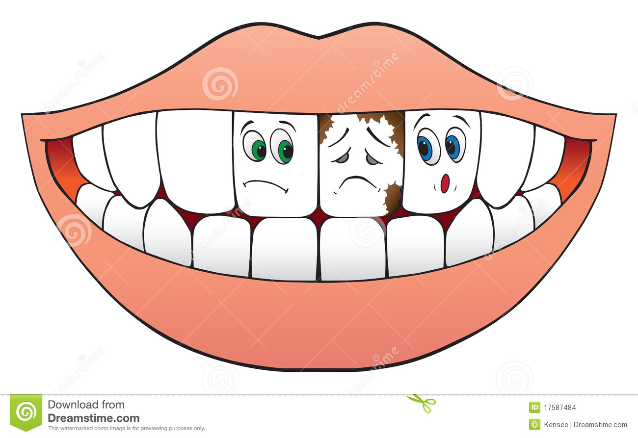 Unhealthy Teeth Clipart Bad T - Clipart Teeth