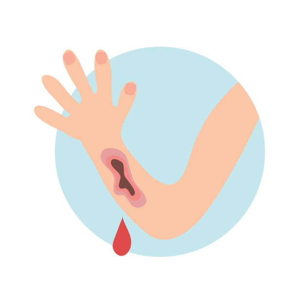 Wounded hand with blood oozing. Blood dripping down. Isolated flat  illustration on a white
